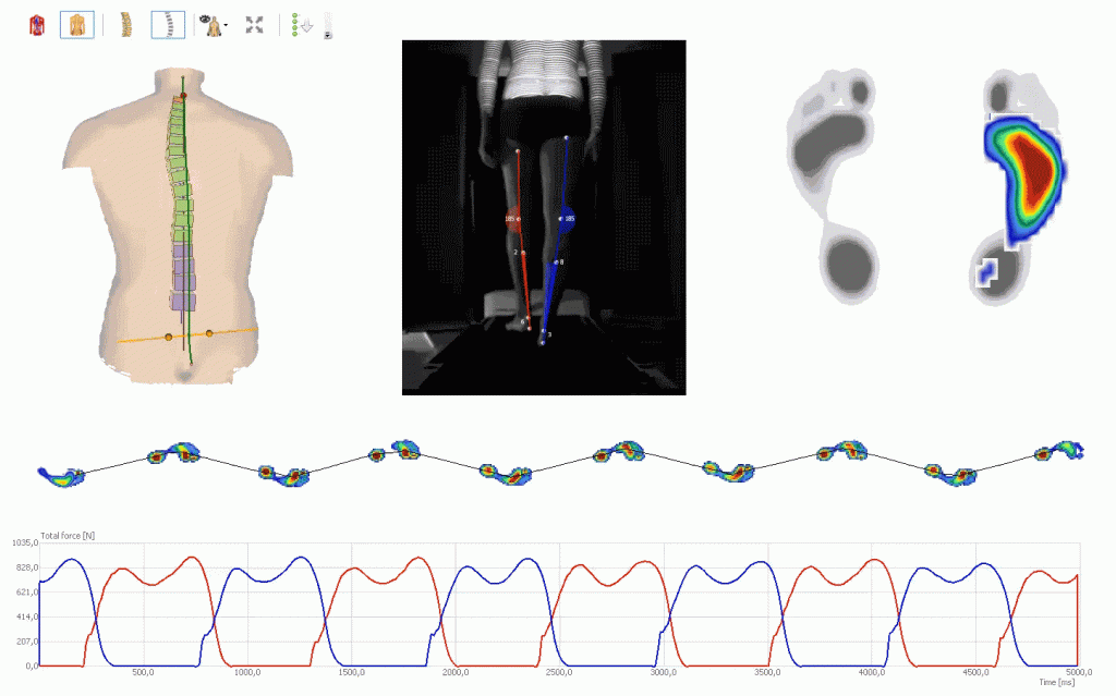 4Dmotion_leg-axis_pedogait